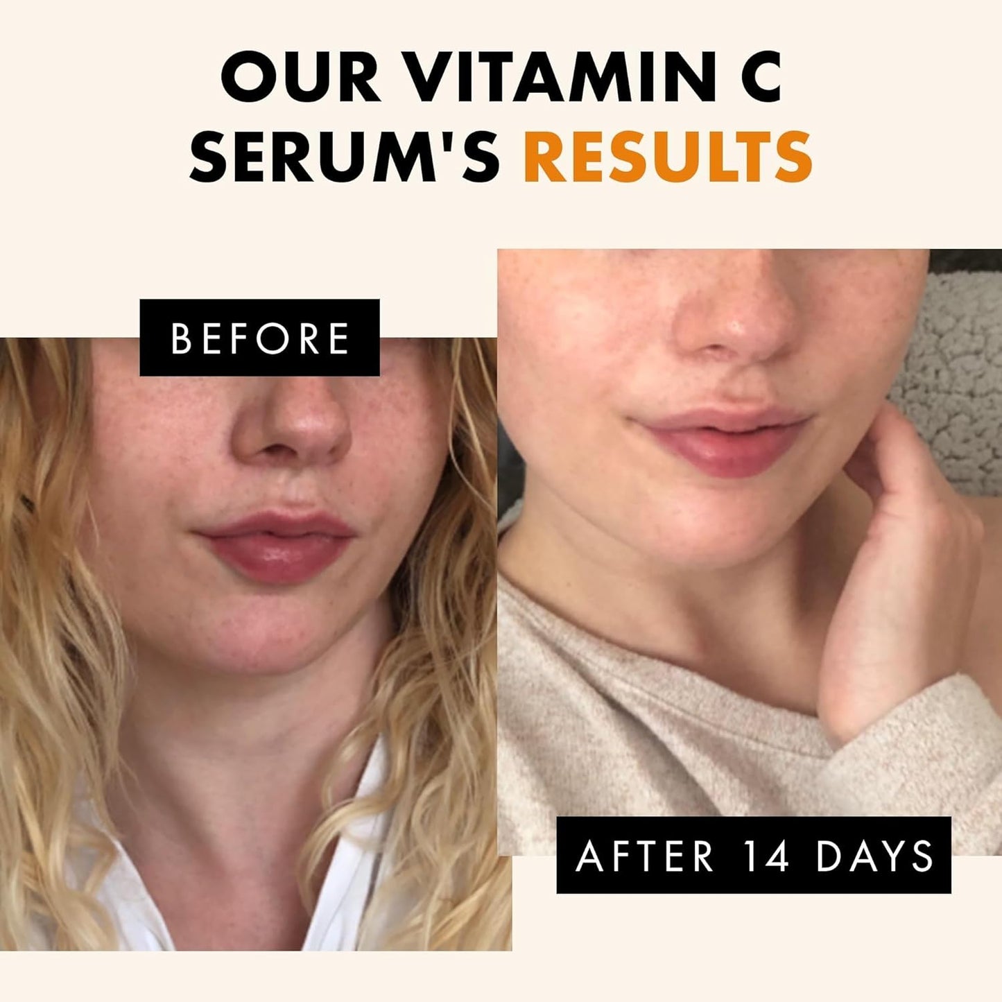 Turmeric Serum